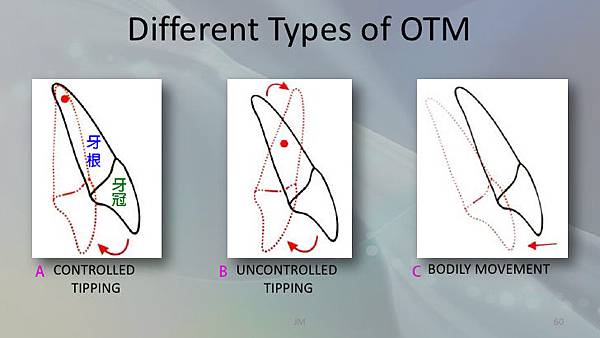 biology-of-orthodontictooth-movement-60-728