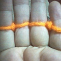 thumb