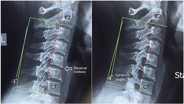 omz115f1 (1).jpg omz115f1 (1).jpg