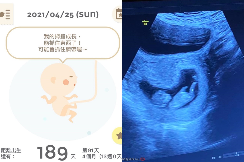 懷孕中期(13W~)營養補給品分享 孕哺兒 新維他命、珊瑚鈣膠囊1.jpg