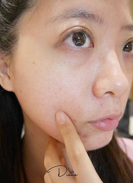 空赏 痘痘敏感肌 6款爱用化妆水及使用方法分