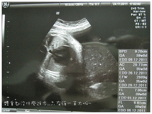 37W+5D