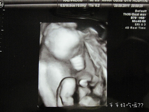 29w+5d