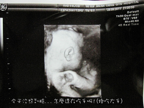 29w+5d