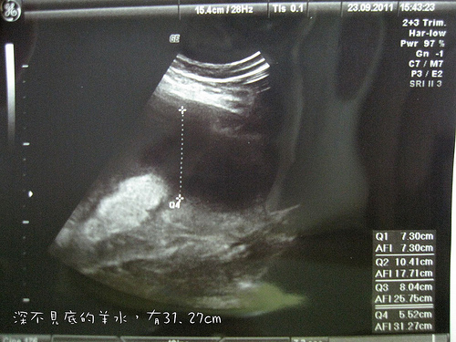 28w+6d