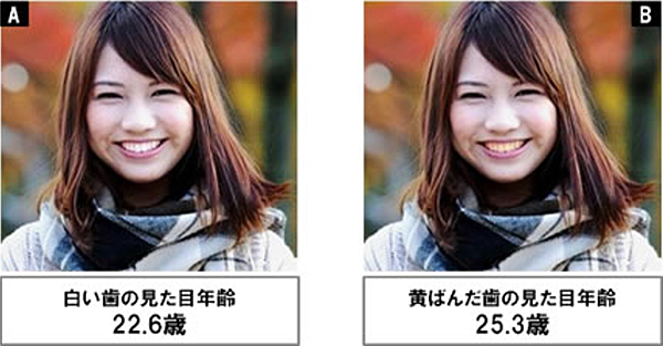 日本調查顯示黃牙會讓人看起來老三歲