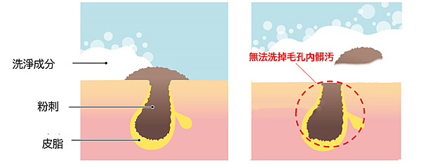 拔黑頭圖.png 拔黑頭圖.png