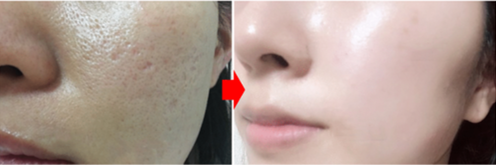 草莓鼻不見.png 草莓鼻不見.png
