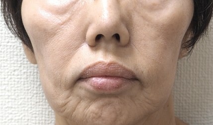 before.jpg before.jpg