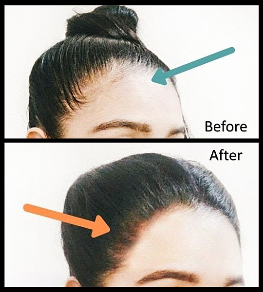 hairline.png hairline.png