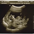 baby ultrasound-11wk.jpg