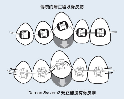 orthodontic_no05_images03