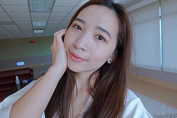 第一次打皮秒雷射美加醫美初體驗:擾人的肝斑該怎麼辦?皮秒會痛嗎?肌膚變亮10倍維持好久~