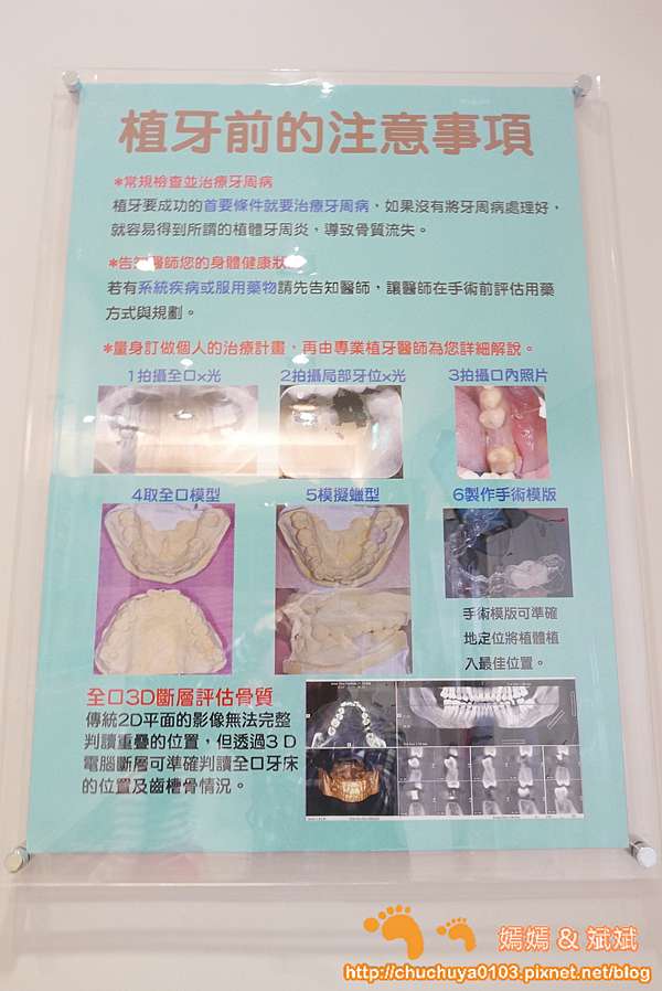 永和牙醫推薦 即拔即種植牙新趨勢 一日舒眠植牙即拔即種療程可選擇 博誠牙醫診所 院長德國植牙碩士何家銘醫師親自操刀 嫣嫣 斌斌 旅遊札記
