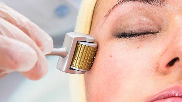 Lăn Kim Tế Bào Gốc Trị Mụn: Gi