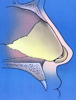 RSD-SeptumProfile