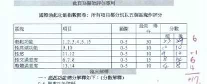 ED table-1