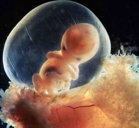 子宮胎兒.jpg
