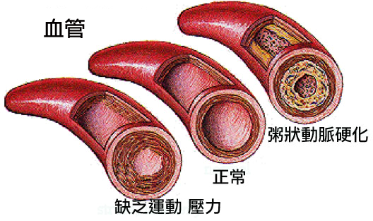 改善血管彈性，縮小血管內粥狀鈣化班