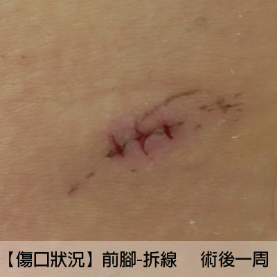 拆線當天 一坨海蒂 痞客邦