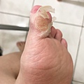 thumb