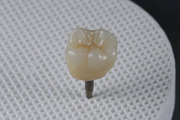 02當天示範牙齒成品.JPG 02當天示範牙齒成品.JPG