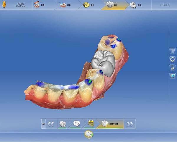 01當天示範假牙外型設計.jpg 01當天示範假牙外型設計.jpg