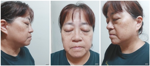 鉑金潤讓我煥亮新生安心逆齡，二代更加緊實抗老安瓶旅行套組(敏