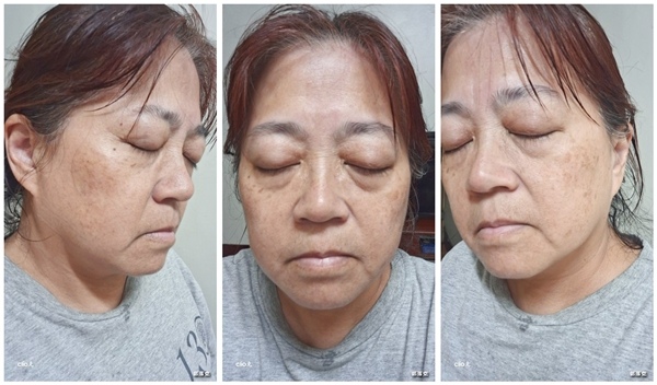 鉑金潤讓我煥亮新生安心逆齡，二代更加緊實抗老安瓶旅行套組(敏