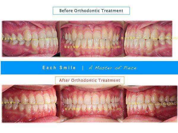 效率與細膩-我的完美矯正 (齊杏齒顎矯正專科)