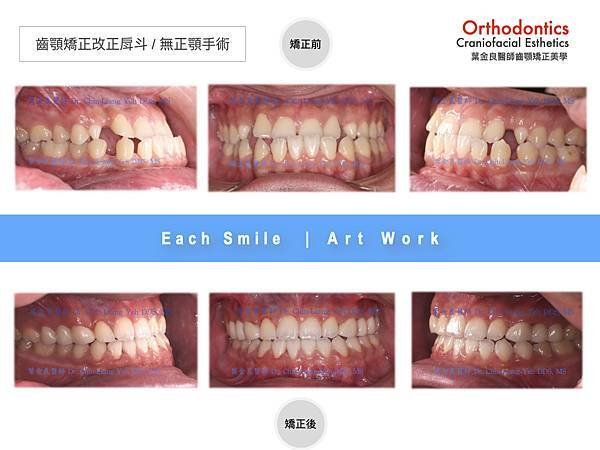 『矯正治療不是解決咬合問題那樣單純，應該是賦予臉部輪廓更深的