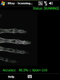xray.jpg xray.jpg