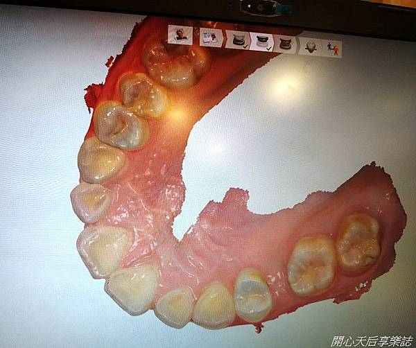均潔牙醫診所 (22).jpg