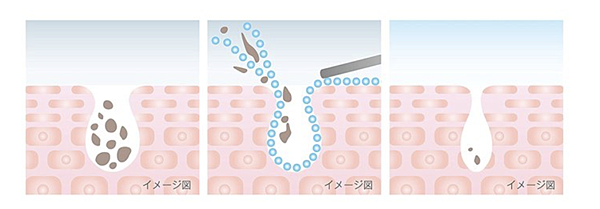 螢幕快照 2018-03-02 下午5.45.31.png