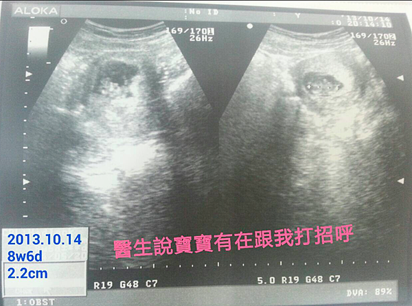 8w6d