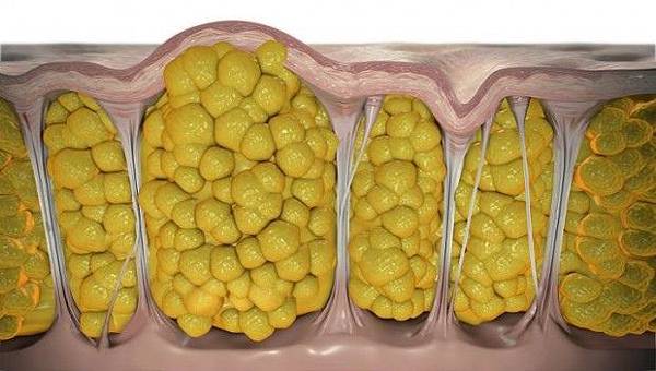 cellulite-620x351.jpg cellulite-620x351.jpg