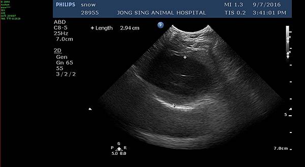 105.09.07小雪超音波囊肝.jpg 105.09.07小雪超音波囊肝.jpg