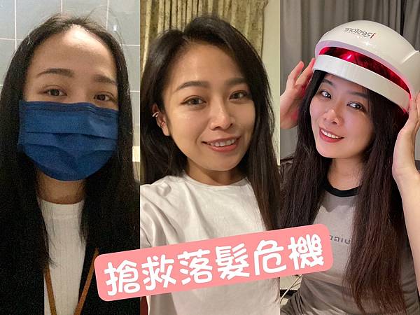 【生髮新選擇】iRestore雷射生髮帽半年心得全紀錄,自信 【生髮新選擇】iRestore雷射生髮帽半年心得全紀錄,自信