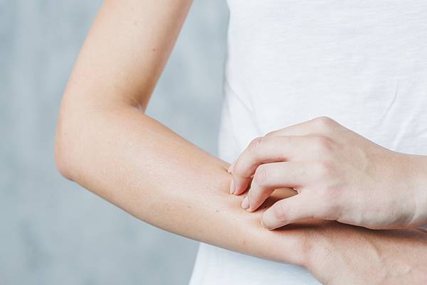 close-up-woman-s-hand-scratching-her-hand.jpg