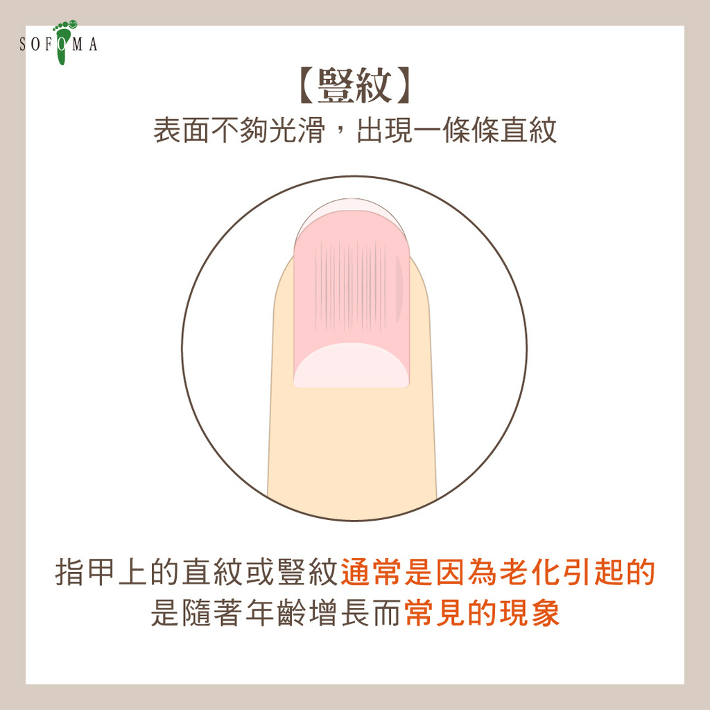 指甲小紋路_03.jpg 指甲小紋路_03.jpg