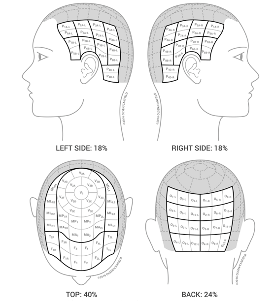 遇到圓禿的落髮問題怎麼辦? 遇到圓禿的落髮問題怎麼辦?