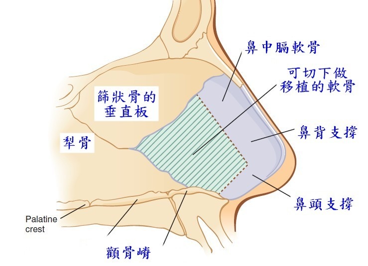 Nose19.jpg