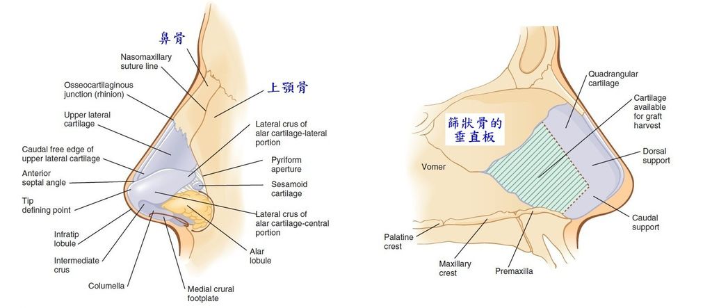 Nose11.jpg