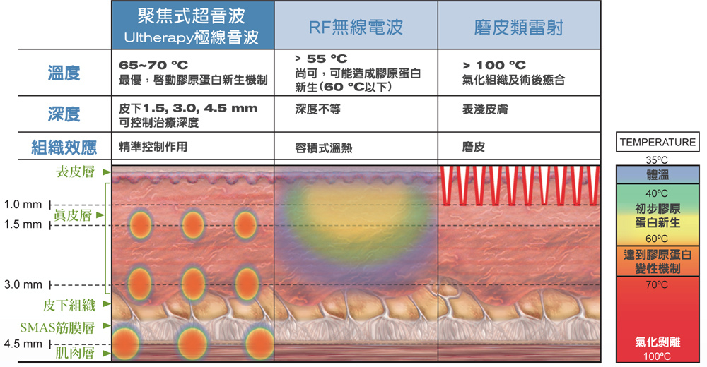 Ulthera04.jpg