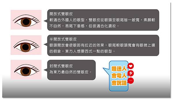 台中雙眼皮|台中雙眼皮手術02 台中雙眼皮|台中雙眼皮手術02