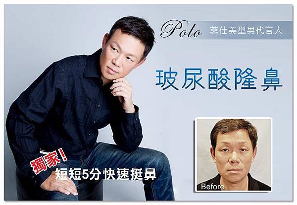 台中玻尿酸|台中玻尿酸隆鼻00 台中玻尿酸|台中玻尿酸隆鼻00