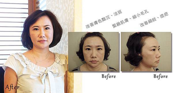 美琪脈衝光文案2.jpg 美琪脈衝光文案2.jpg