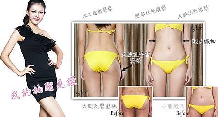 bunny抽脂-腿臀文案2.jpg bunny抽脂-腿臀文案2.jpg
