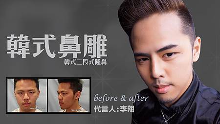 台中隆鼻韓式鼻雕|隆鼻權威醫師|台中菲仕美楊學穎 台中隆鼻韓式鼻雕|隆鼻權威醫師|台中菲仕美楊學穎