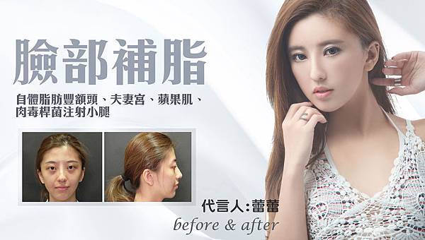 台中自體脂肪豐頰臉部補脂台中菲仕美